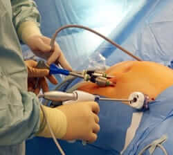 revisional-operation