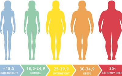 How do I know if I’m eligible for bariatric surgery?