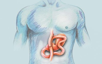 Difference between gastric bypass and mini gastric bypass